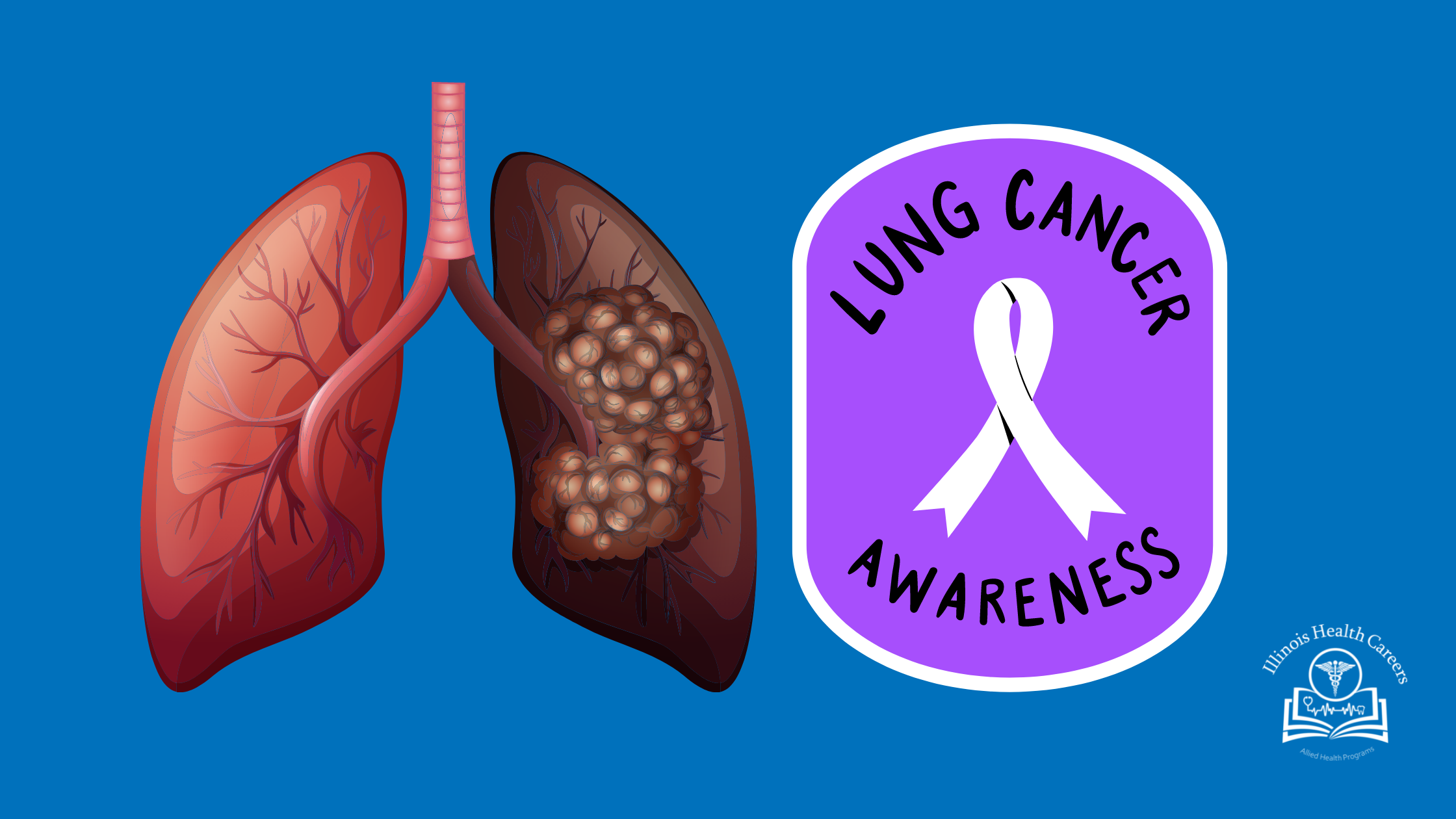 Lung Cancer Awareness Month