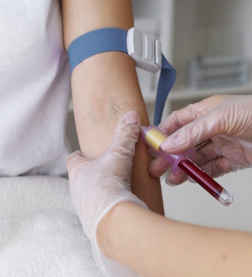 Phlebotomy