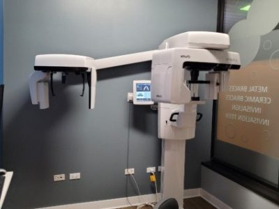 x-ray-1