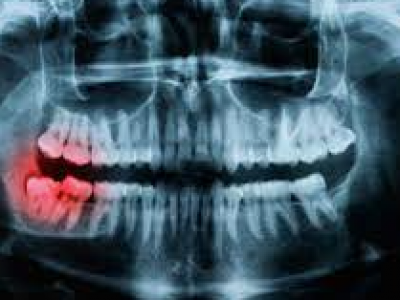 x-ray-2